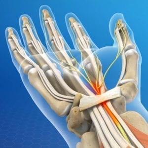 Carpal Tunnel Repair