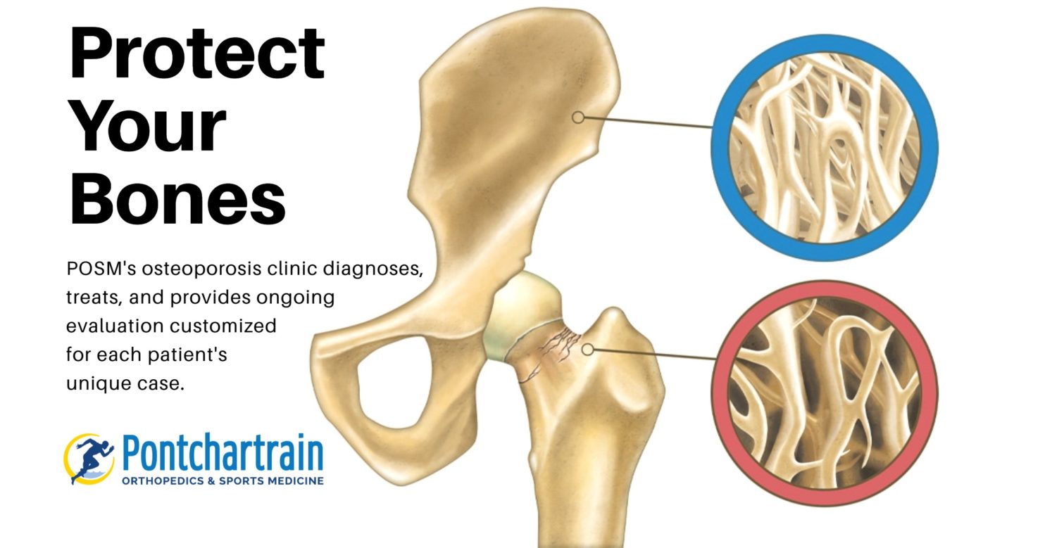 Osteoporosis Clinic