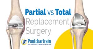 Partial vs Full Knee Replacement - Pontchartrain Orthopedics