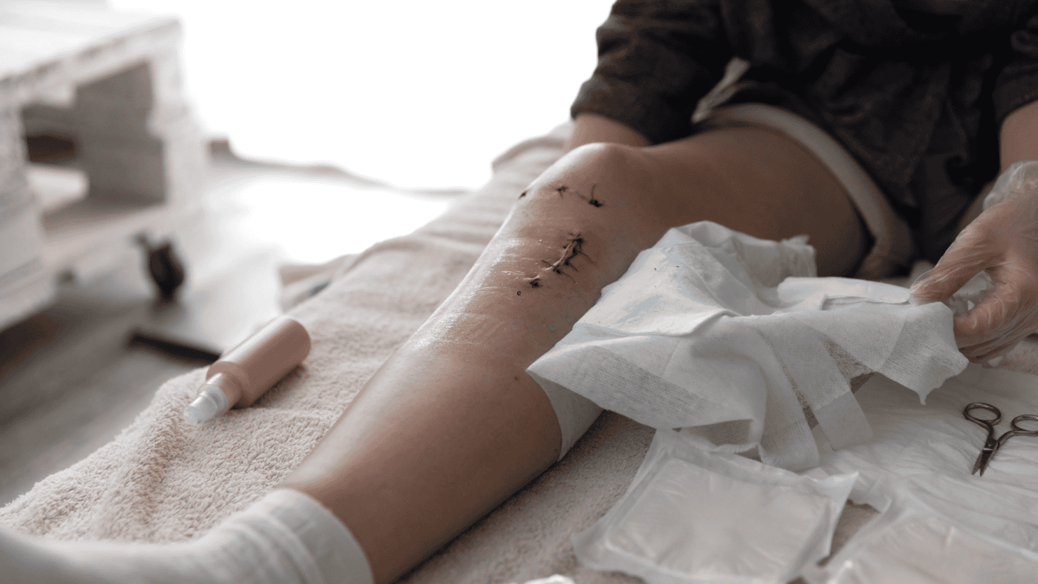 recovery after surgery