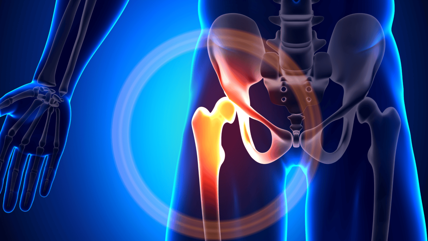 joint replacement